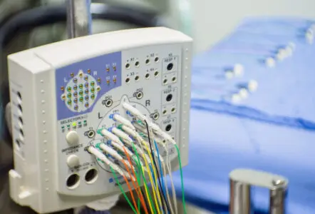 Multiple cables plugged into an ECG