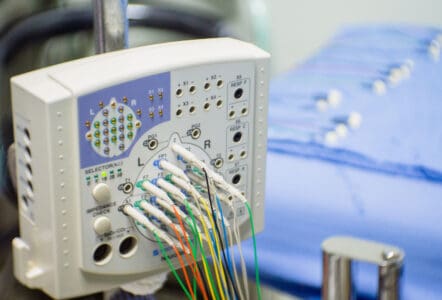 Multiple cables plugged into an ECG